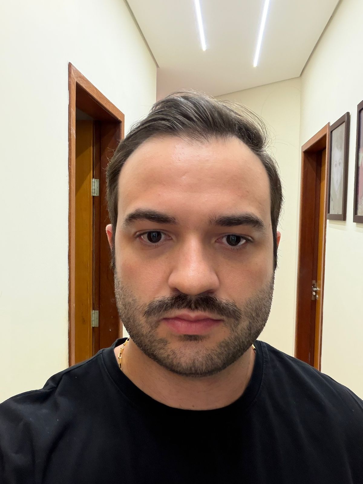 Antes